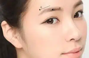 cắt mí ở đâu 3