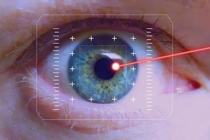 Điều trị laser