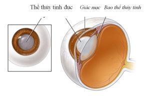 dịch vụ Mắt Bình Tâm