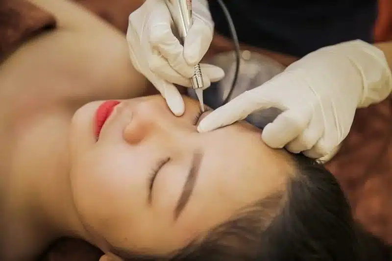 Ứng dụng Laser CO2 trong điều trị nhãn khoa hiện nay