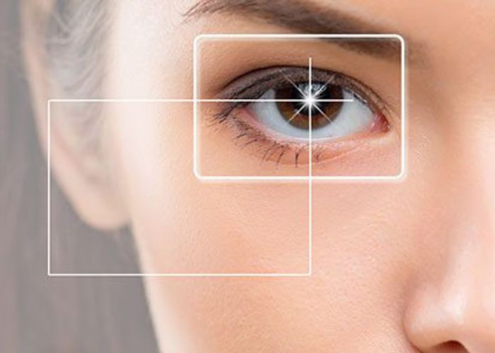 Phương pháp phẫu thuật mắt cận Femto Lasik 3