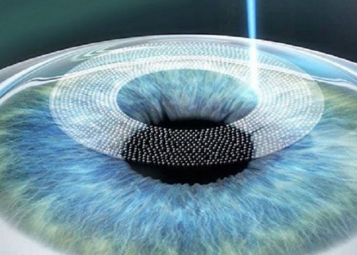 kính tiếp xúc Ortho k 4